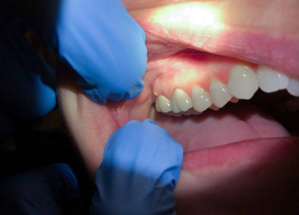 Dentist for Dental Trauma in KY
